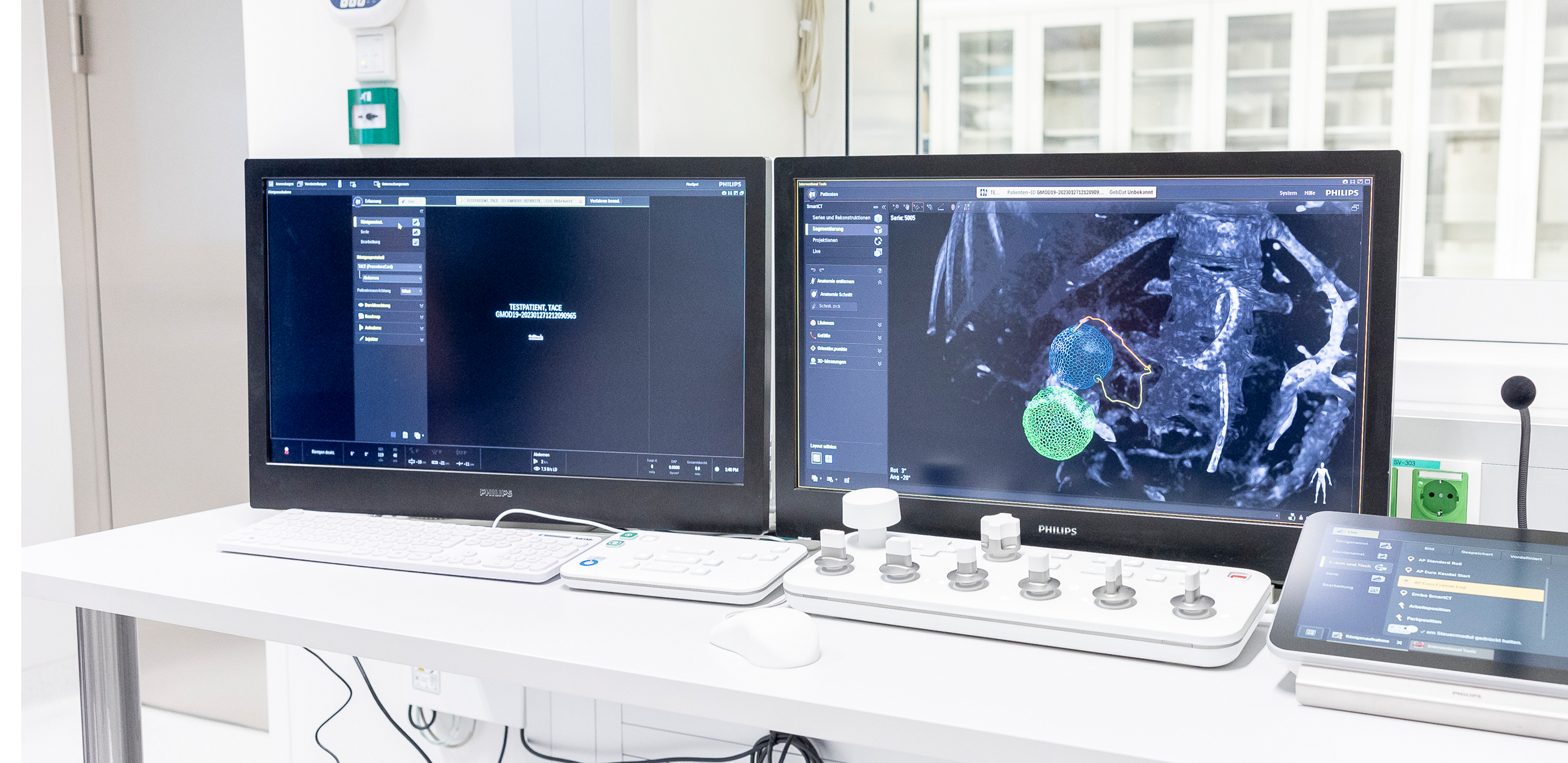 Ein Bildschirm zeigt Untersuchung in der Angiographie